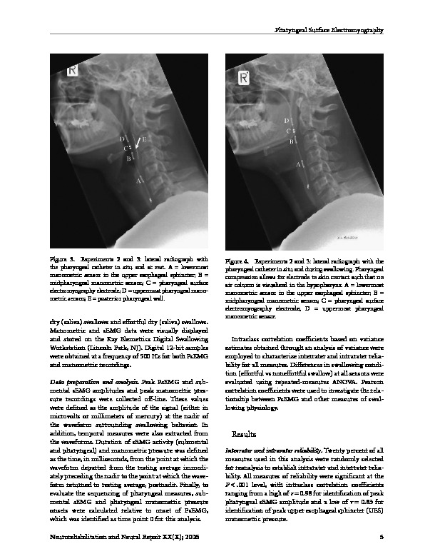 Download Clinical measurement of pharyngeal surface electromyography: exploratory research.